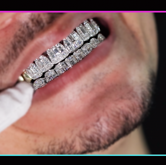 moissanite diamond iced out grillz